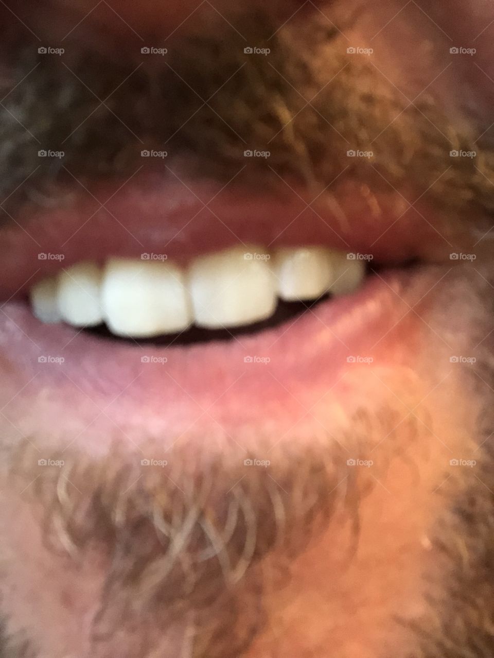 Teeth with goatee. 