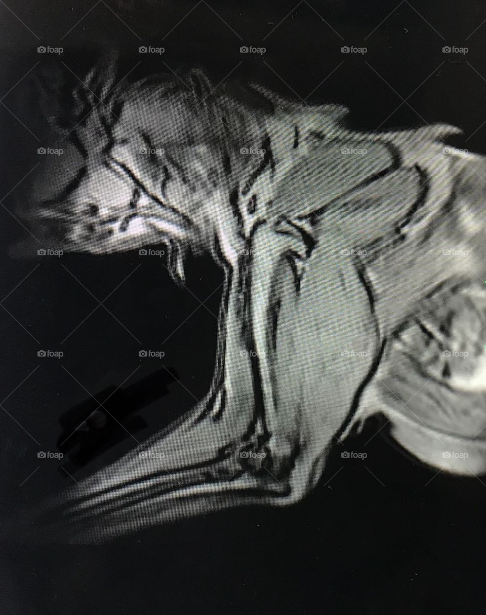 10 year Golden Retriever MRI, showing sagittal view (longitudinal) of left shoulder and neck.  MRI is the preferred imaging modality in specialty veterinary medicine to diagnose many soft tissue injuries.  