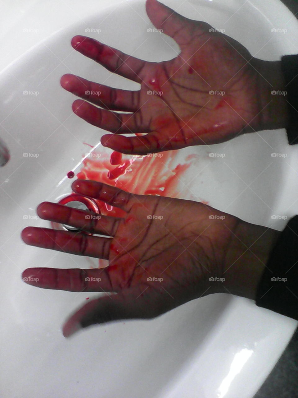 Blood on my hands