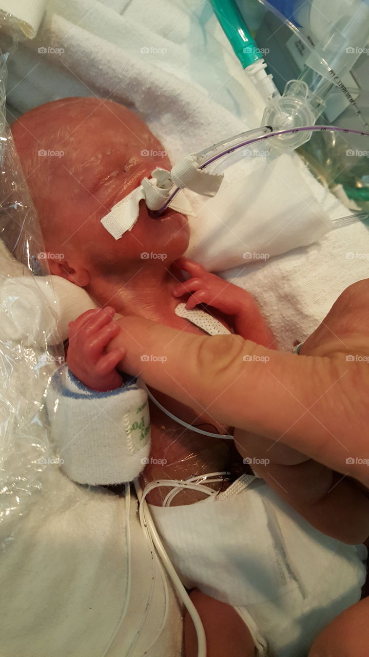 Born at 26 weeks gestation, he still knew Dad's finger. Shot 2 hours after birth.