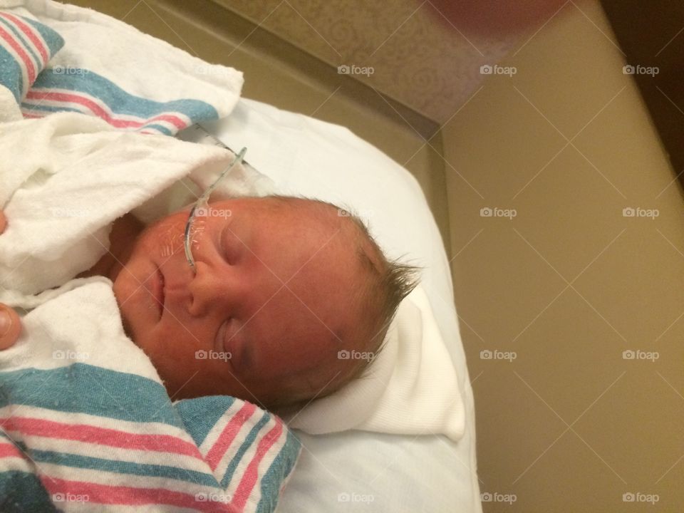 Newborn with Down syndrome soon  after birth, birth diagnosis