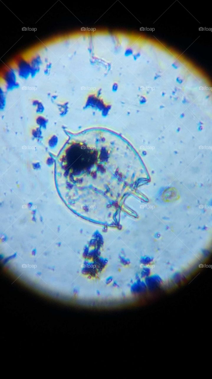 microscopic image of fresh water creature