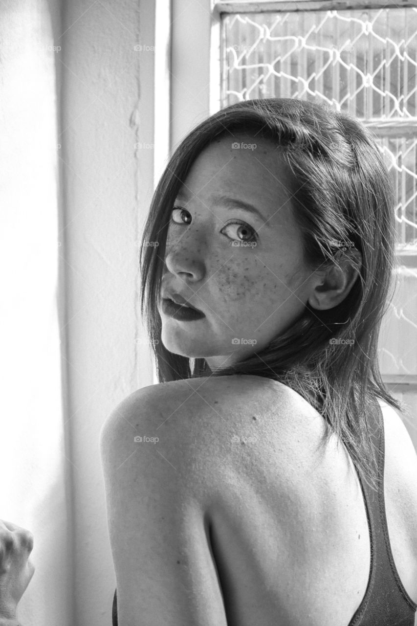 Freckles