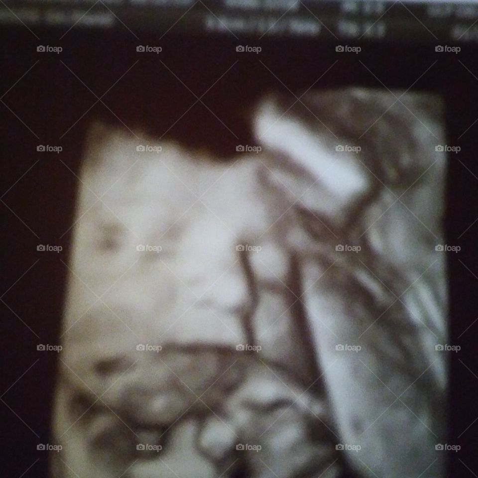 My baby boy 3D ultrasound!