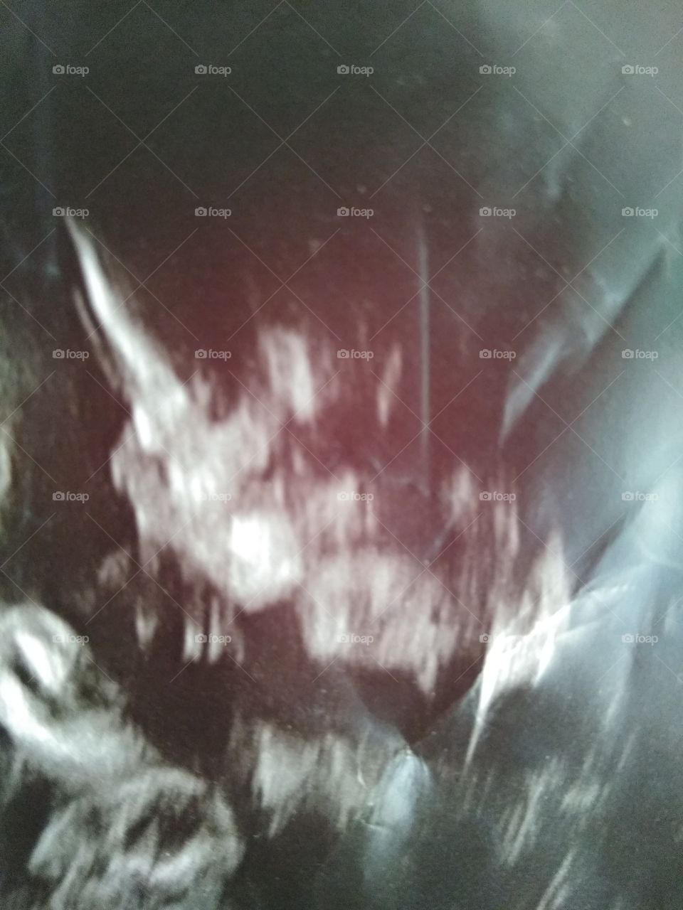 baby girl ultrasound due June,11,2018