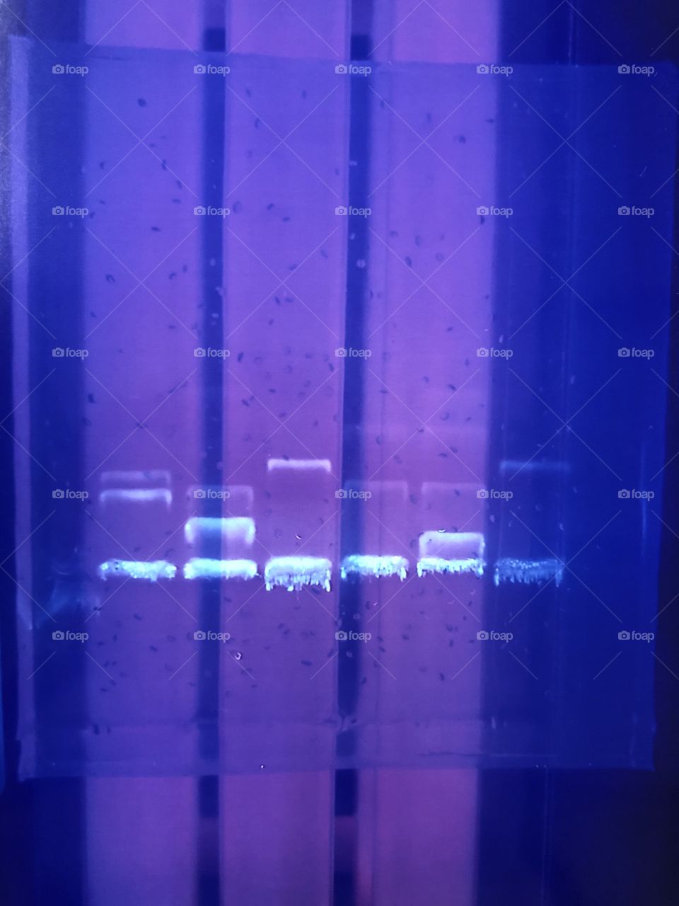 This is an electrophoresis gel with DNA and a marker. This is the process used for finding out who committed a crime by analyzing whether their DNA matches with the marker( the marker would be something they touched or a blood sample) 