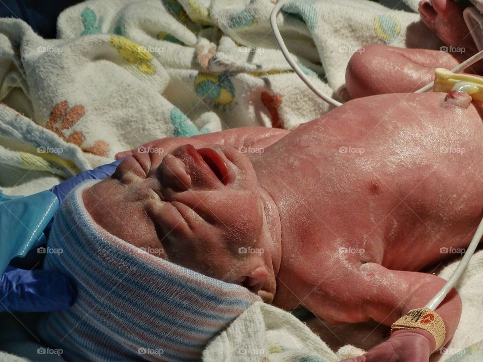 Premature Newborn Infant
