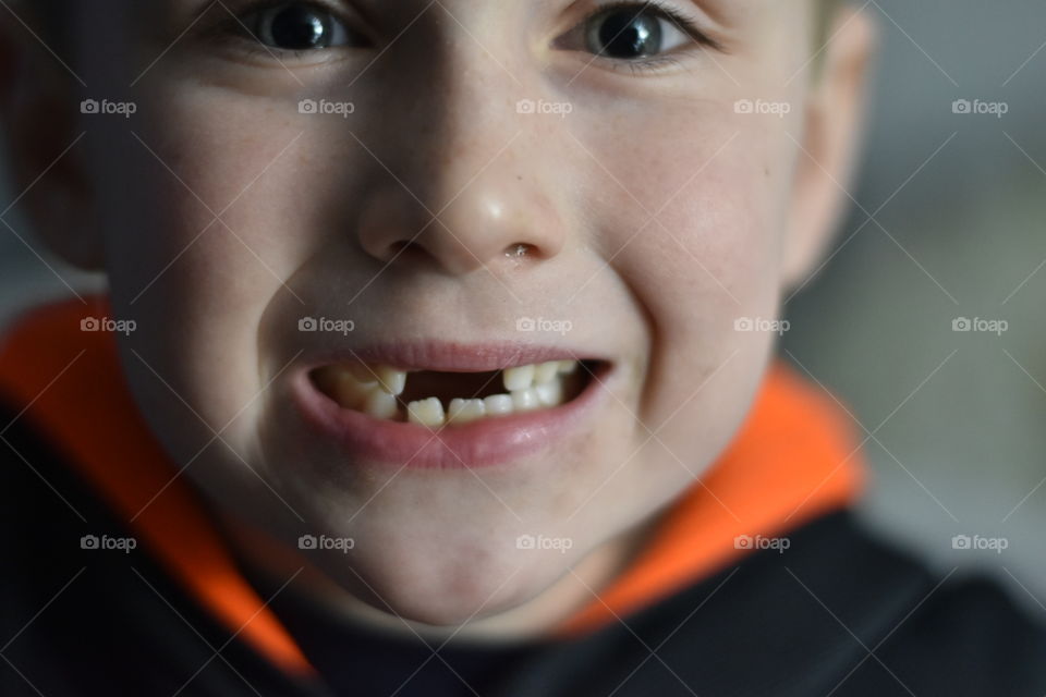 Two front teeth