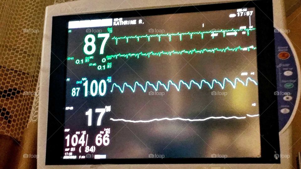 Atrial Flutter Blues