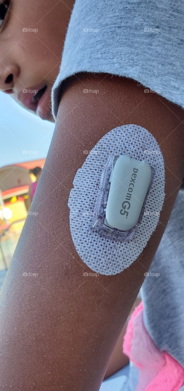 Blood glucose monitor device