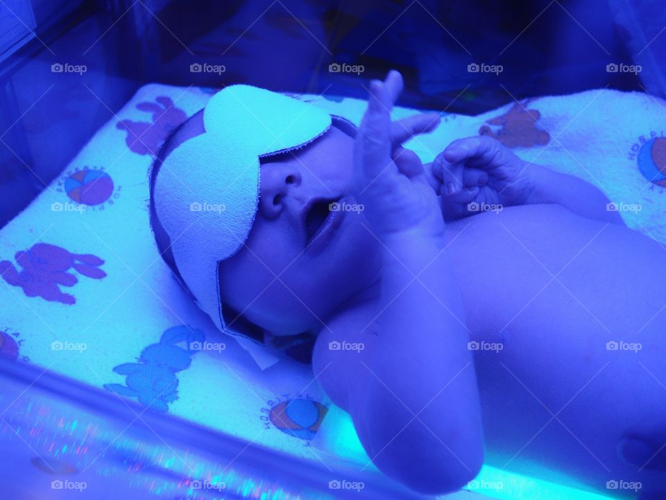 Newborn Under Ultraviolet Lights
