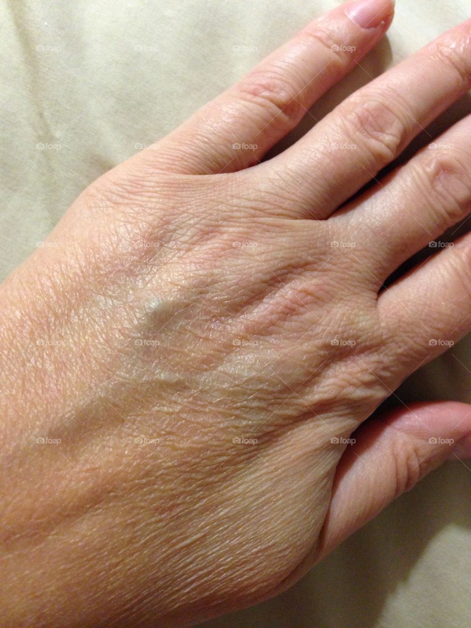 This is the left hand of a 44 year old Caucasian female.