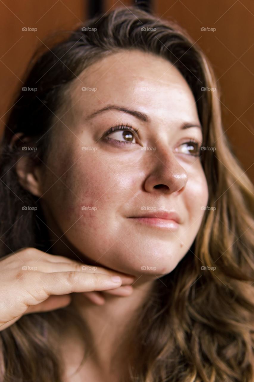 Moles, sun kissed freckles and mysterious red patches. This is how my skin expresses itself. 