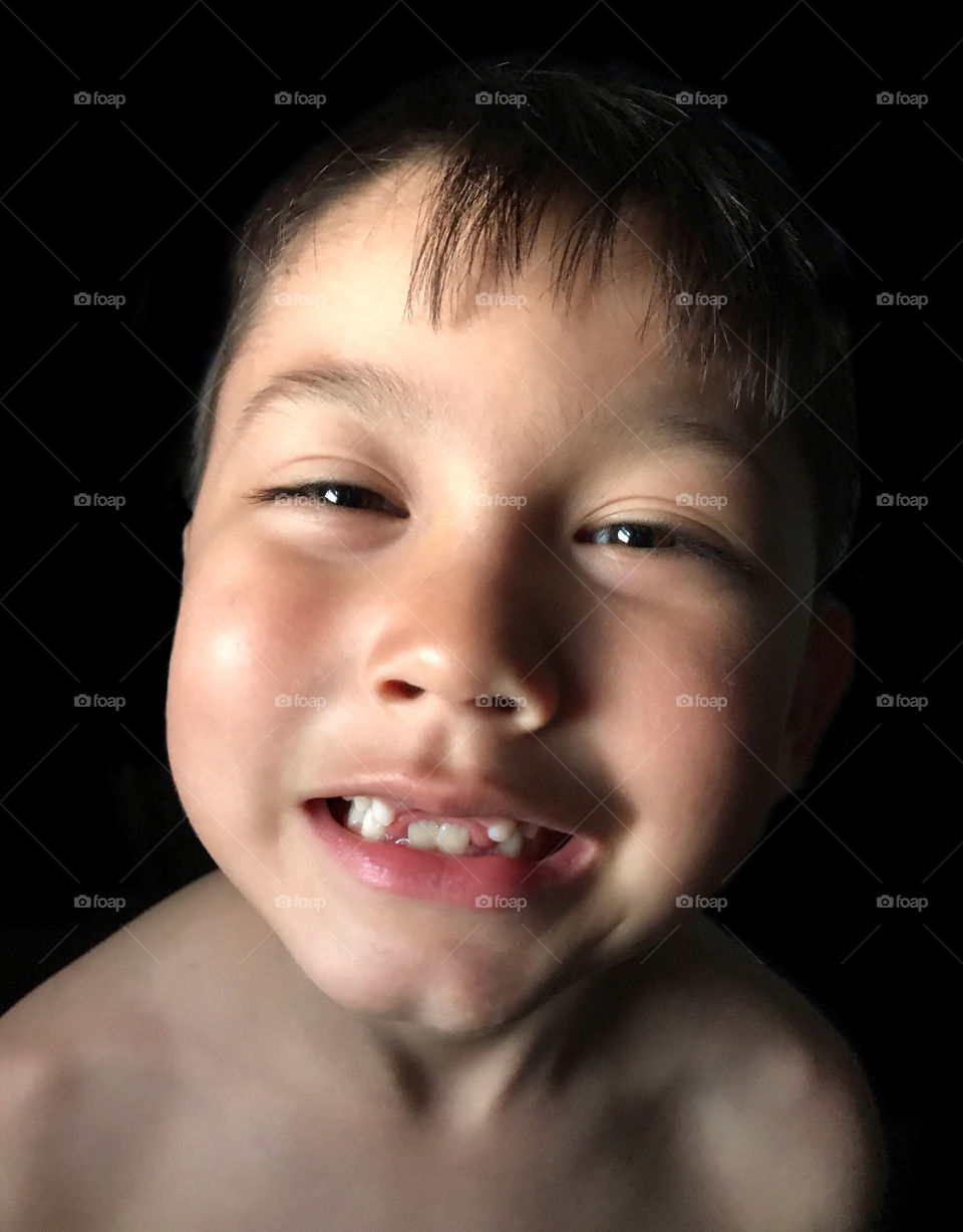 A young boy with missing teeth shows off his smile