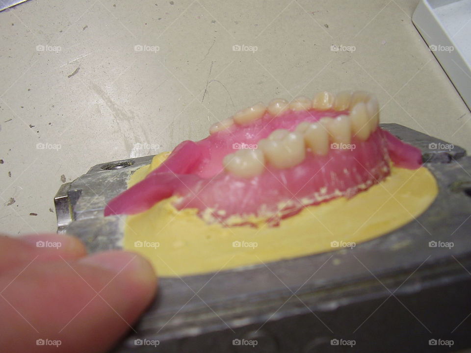 full full denture dental technology standard