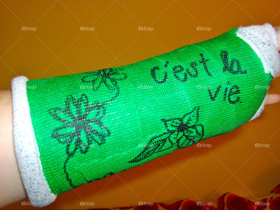 Arm cast