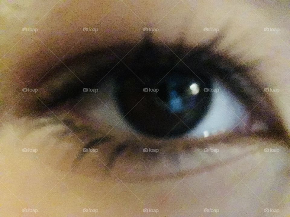 Eye 