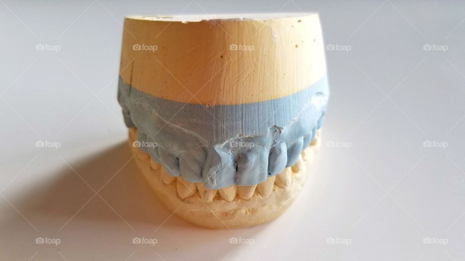 Dental crown molding
