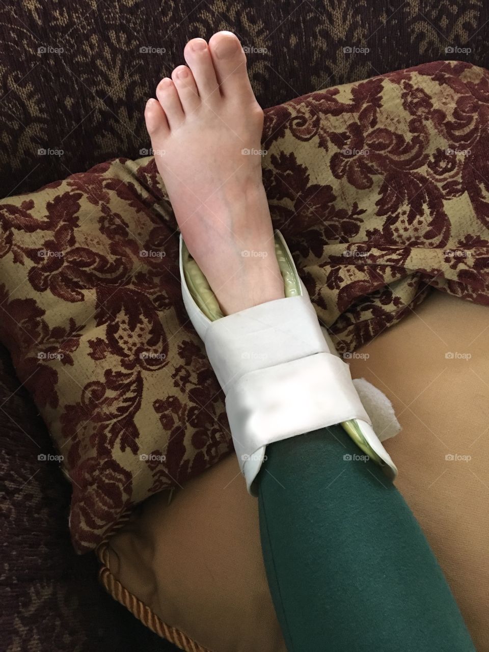 A woman’s injured foot in an ankle brace rests on a pile of sofa cushions