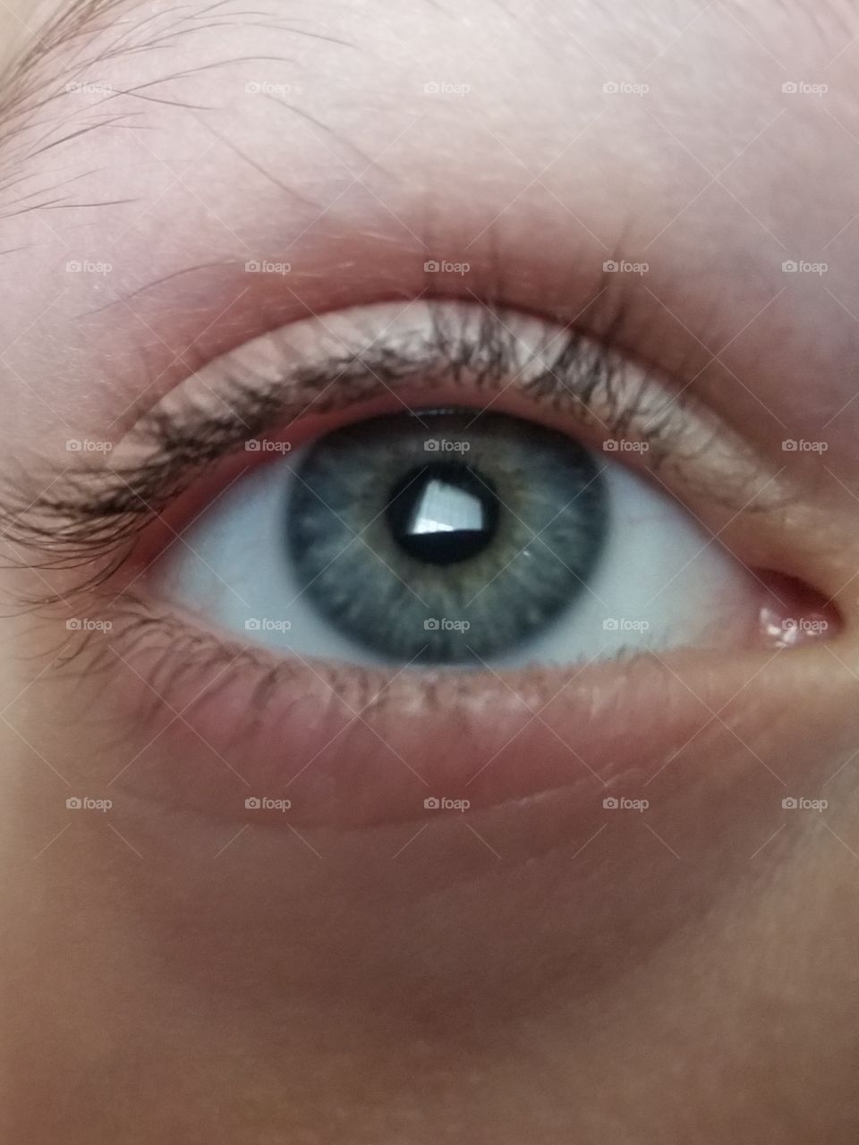 Blue eyeball