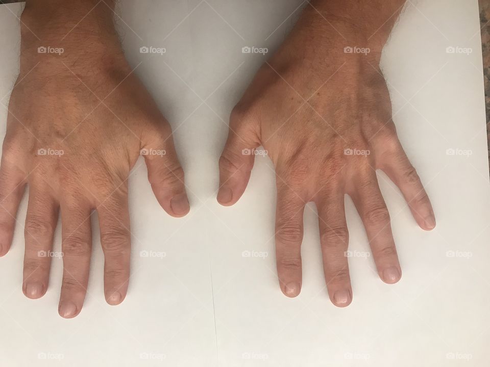 Hands top