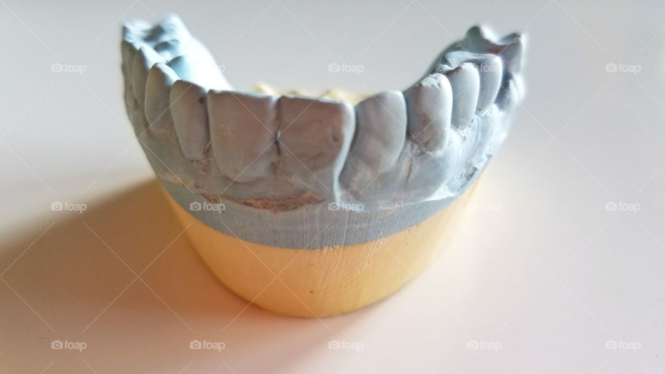 Dental impressions