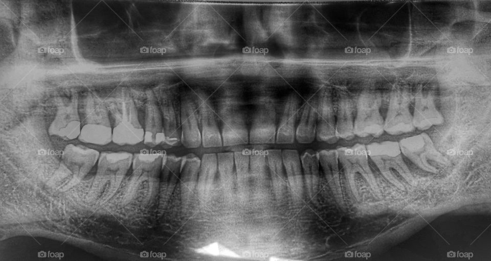 Panoramic facial scan. Scan of my teeth