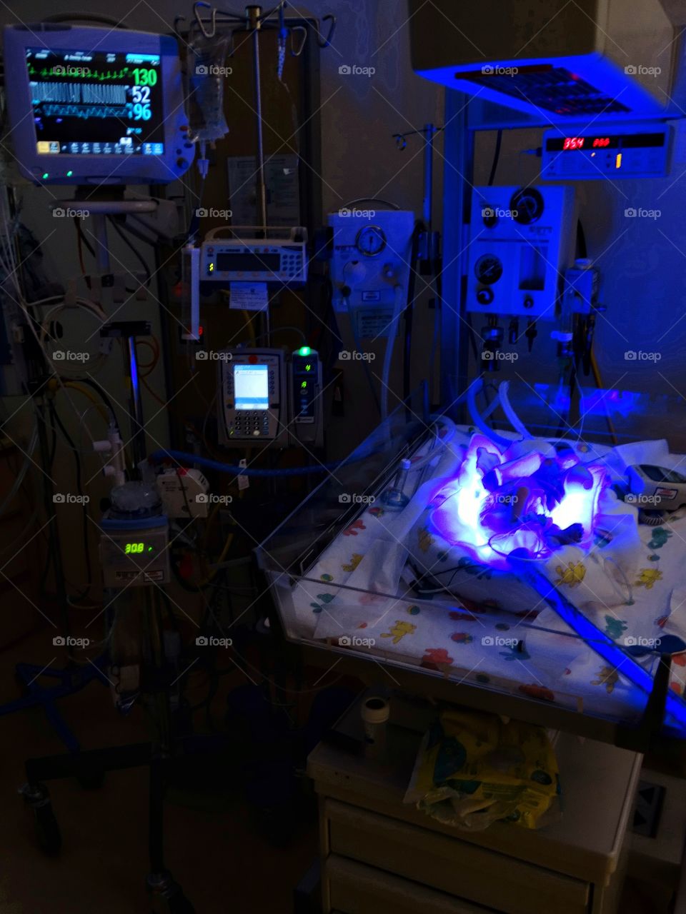 Newborn Infant Under Ultraviolet Lights
