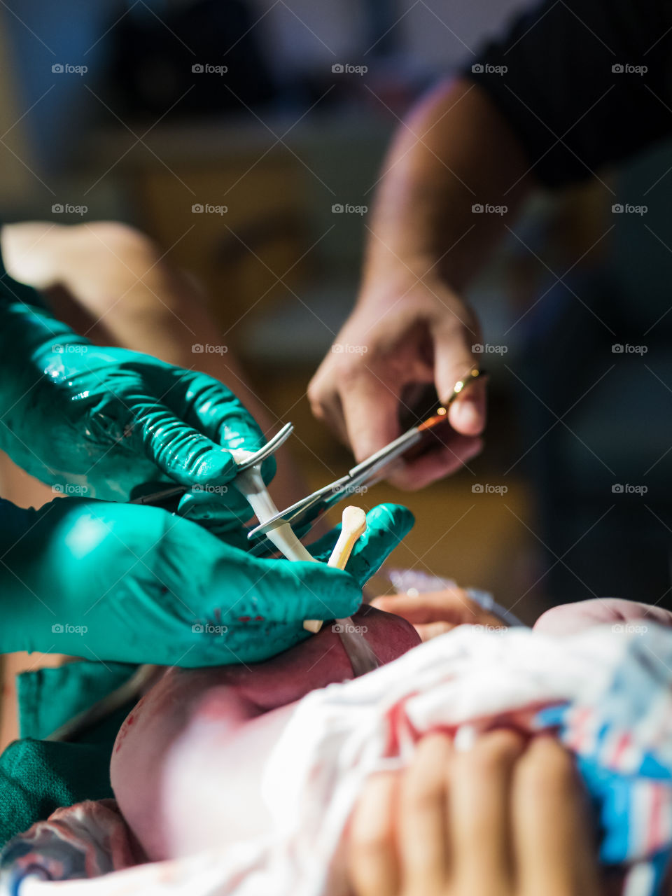 Father cuts umbilical cord of newborn son. 
