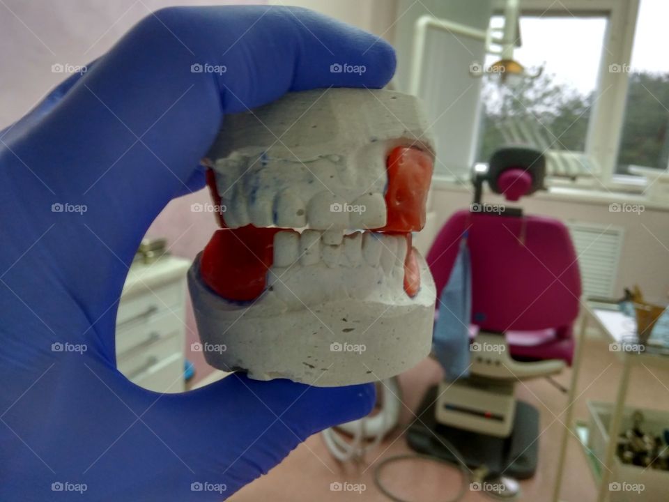 Dental model