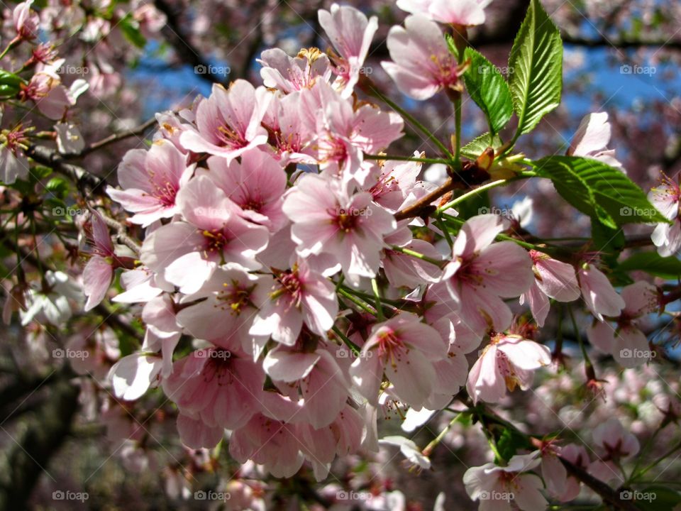 Beauty shining through