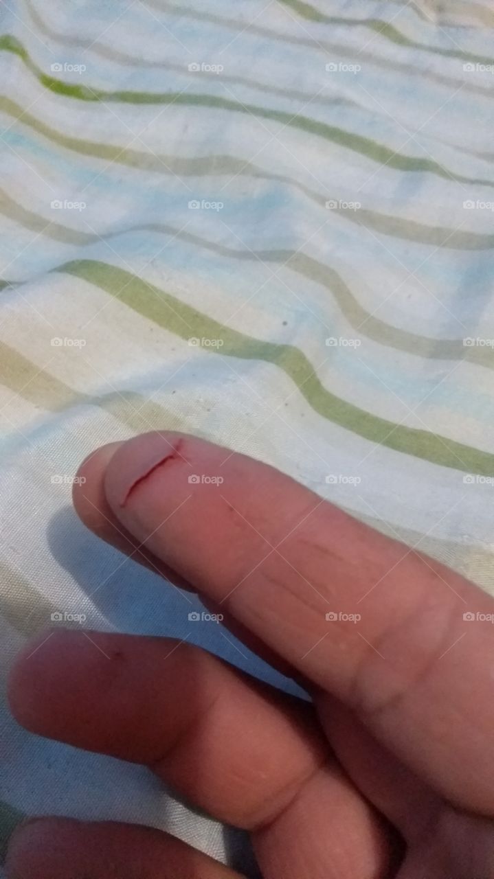 corte no dedo