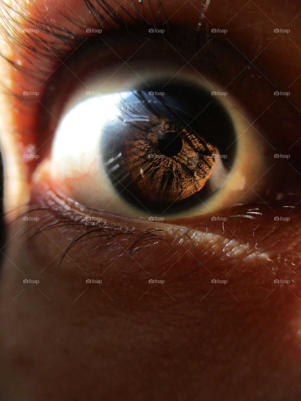 iris eye