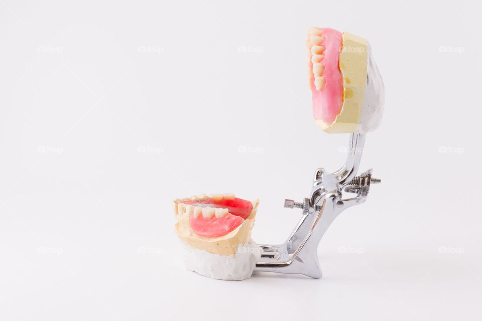 Wax dentures