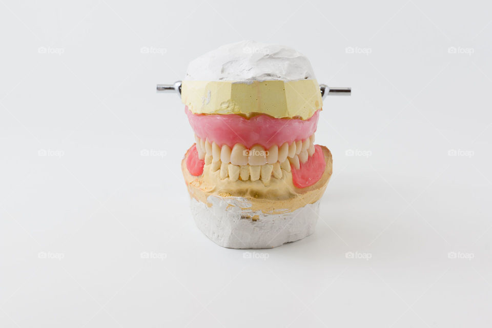 Dental composition