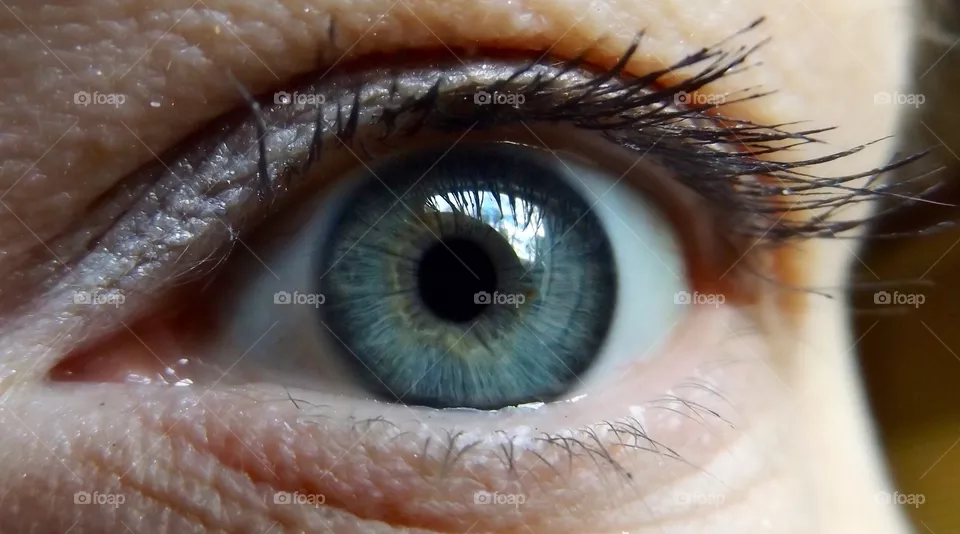 Eye