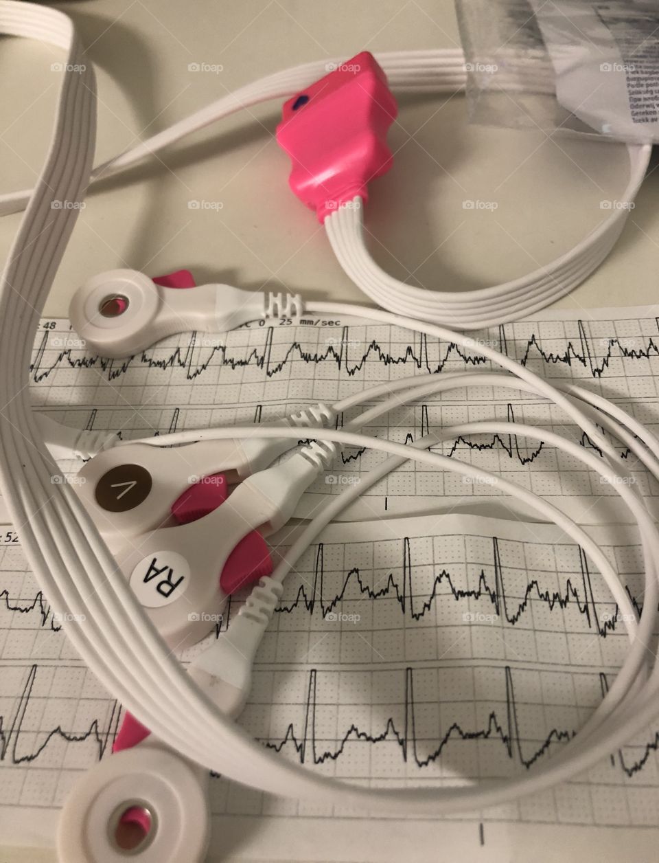 Heart Monitor Leads; Rhythm Strips; The Beat Goes On