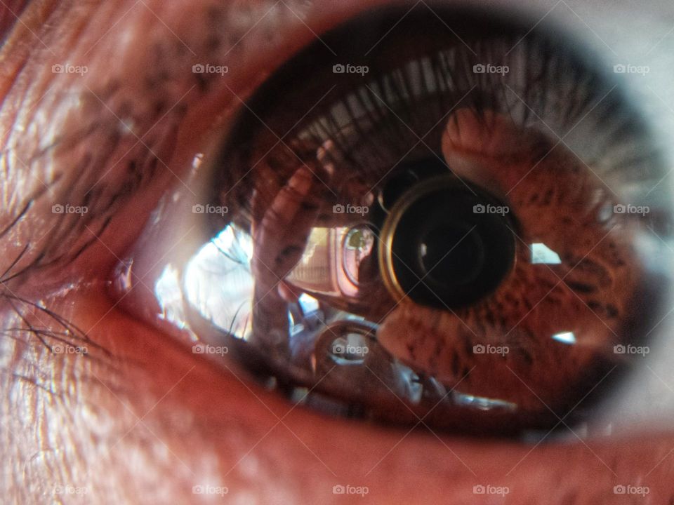 lens reflection in the eye.
