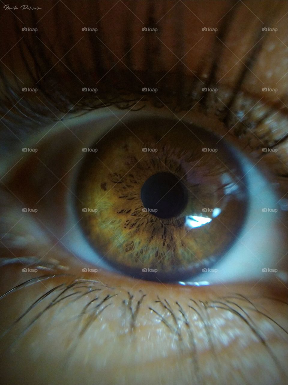 my eye