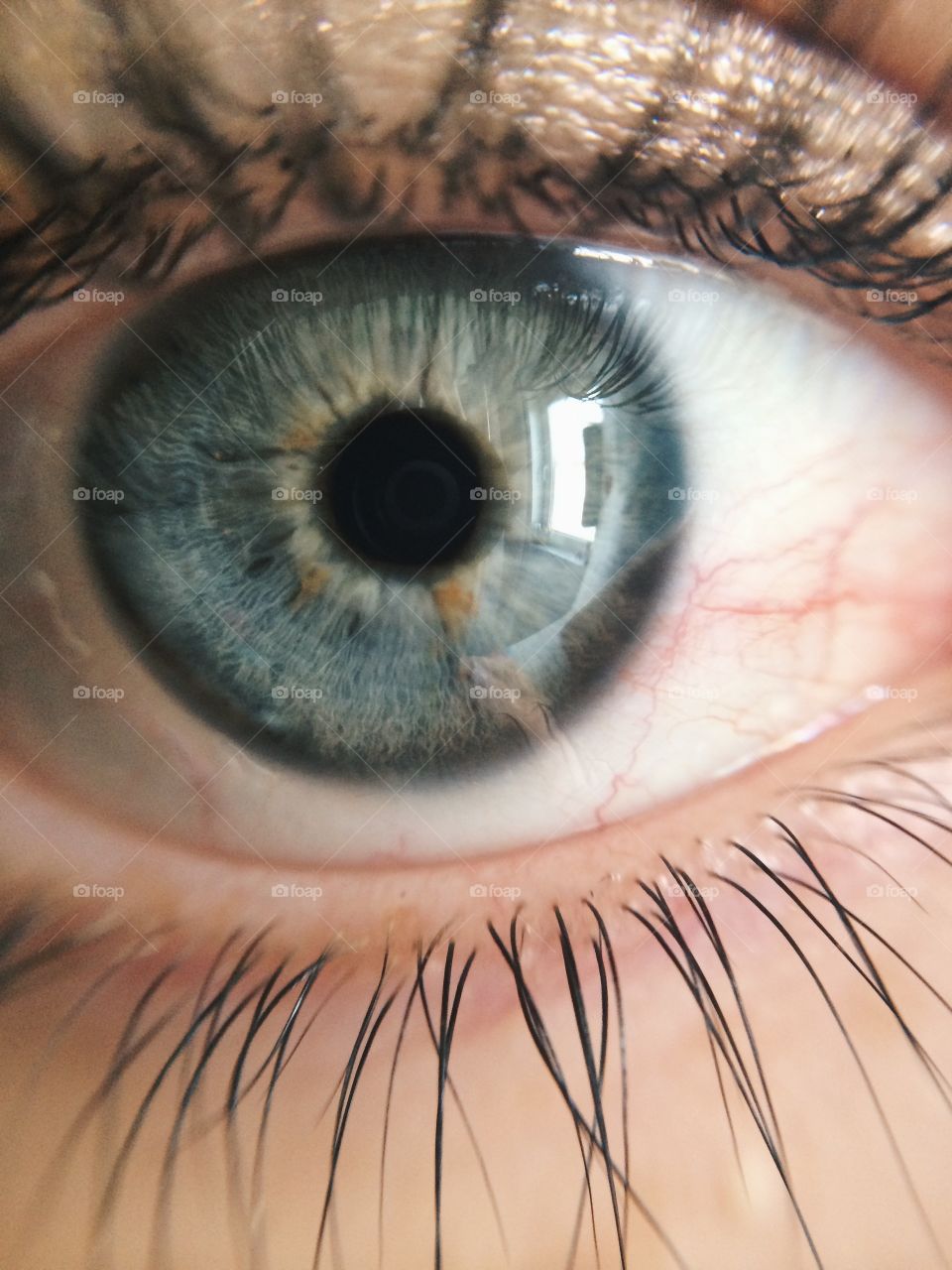 Eye