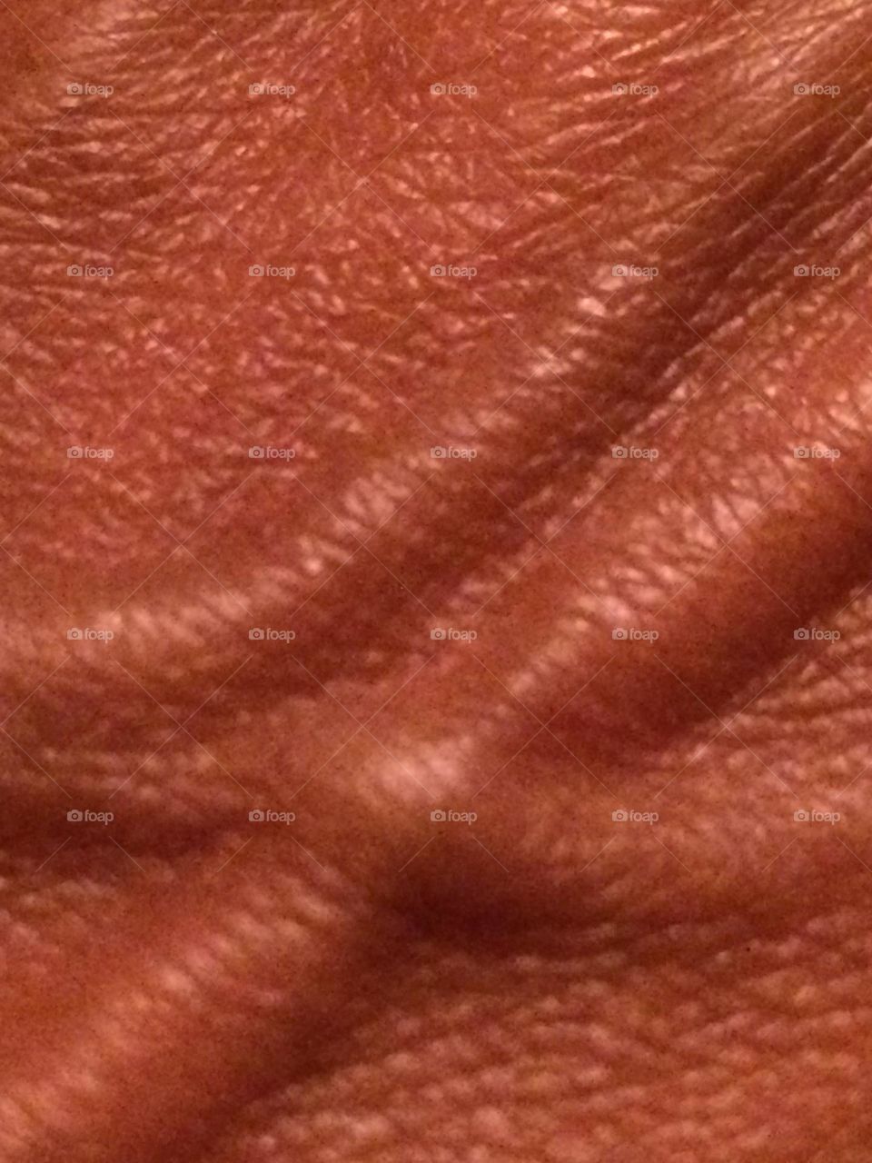 Veins on the back of the Hand