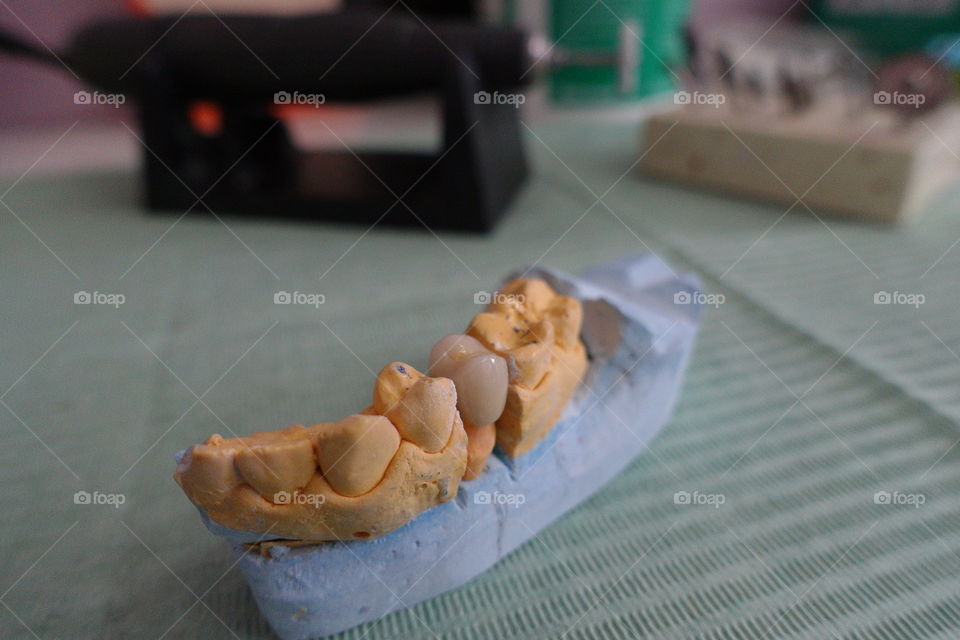 Dental ceramic crown