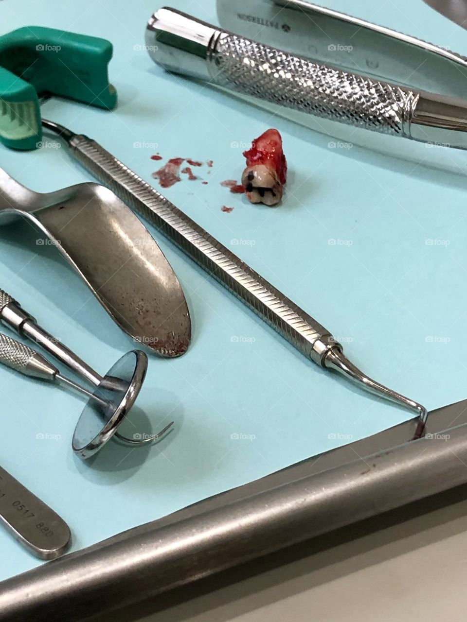 Tray of dental tools and bloody extracted tooth