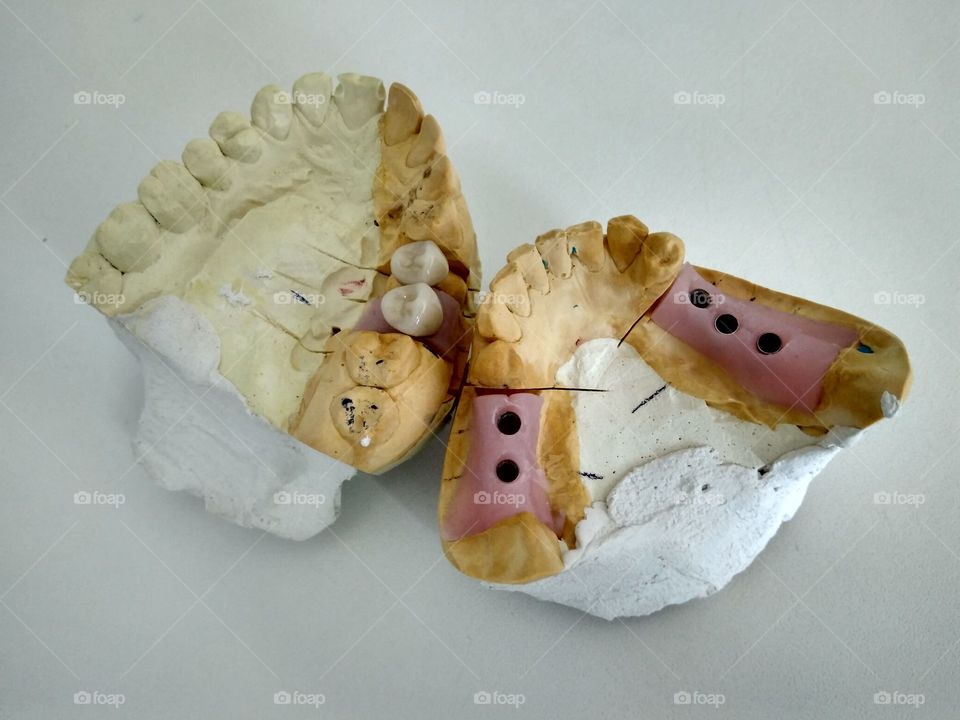 Artificial model for dental implantation