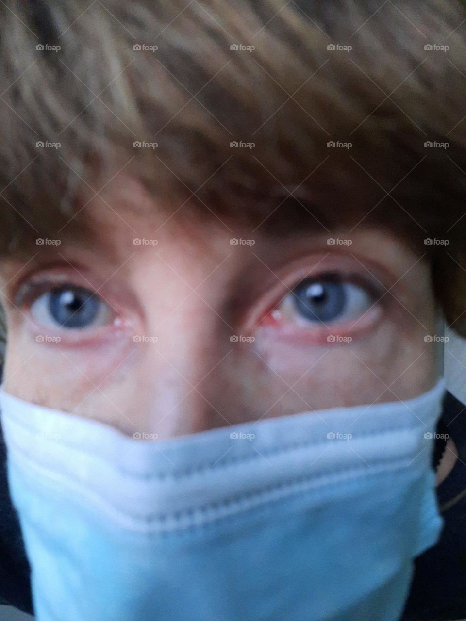 blue eyes of a woman with conjunctivitis