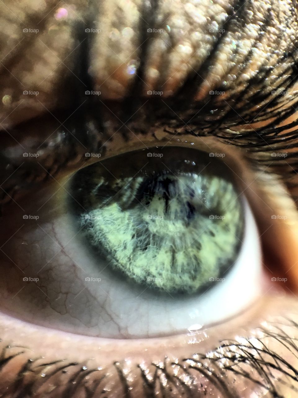 Eye