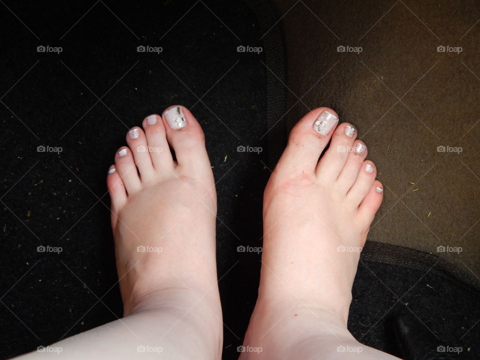 Swollen foot
