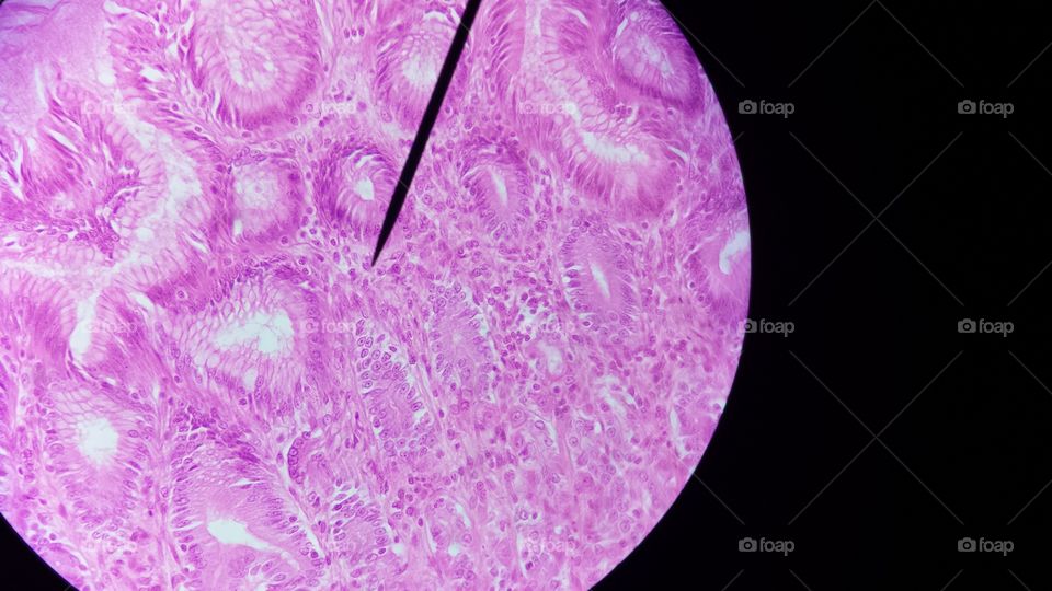 under the microscope