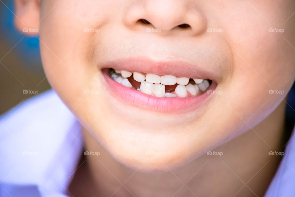 Baby teeth are just dropped in the mouth and regenerate tooth.