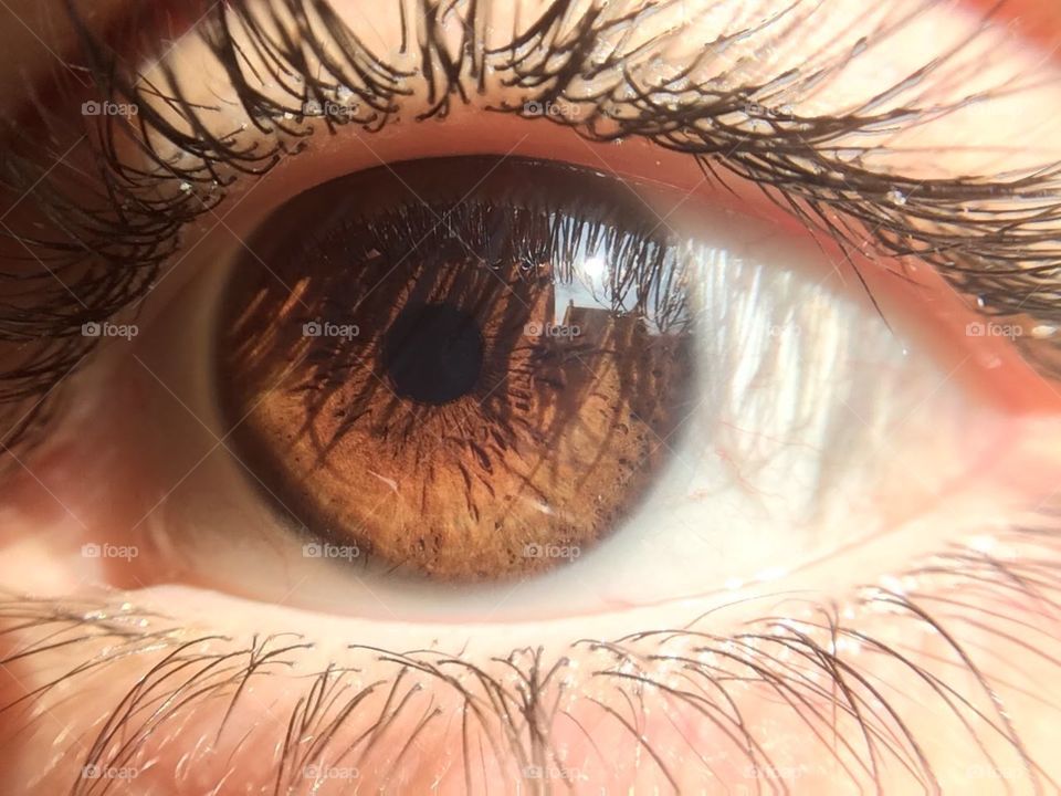 Brown colored eye